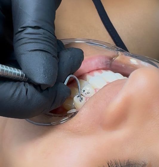 Formación técnico en joyería dental   SIN KIT PROFESIONAL